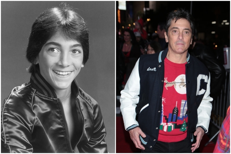 Scott Baio (1970s-1980s) | Getty Images Photo by NBC Photo & GP/Star Max