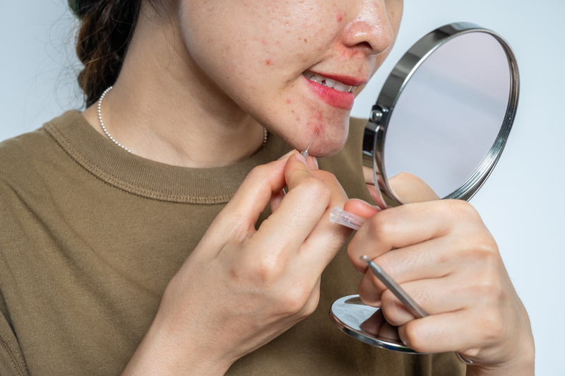 Pimple Popping With Needles | Shutterstock