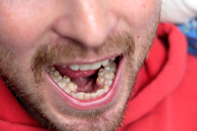 Jeepers Creepers, Where'd You Get Those Chompers | Alamy Stock Photo