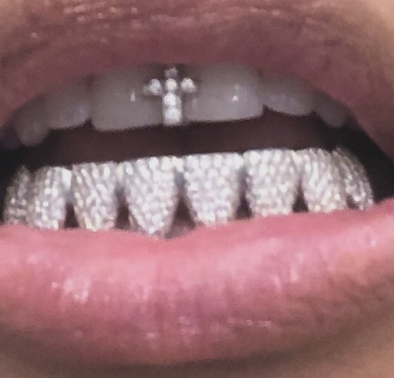 Dentadura de diamantes | Instagram/@kimkardashian