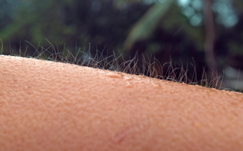 Si se te pone el pelo de punta, actúa | Shutterstock