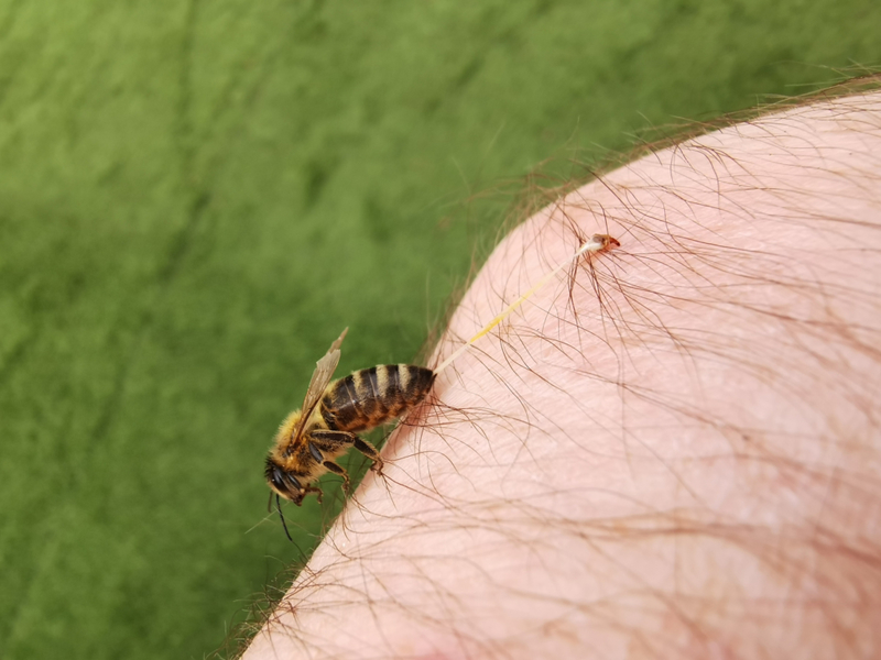 La picadura mortal de una abeja | Shutterstock