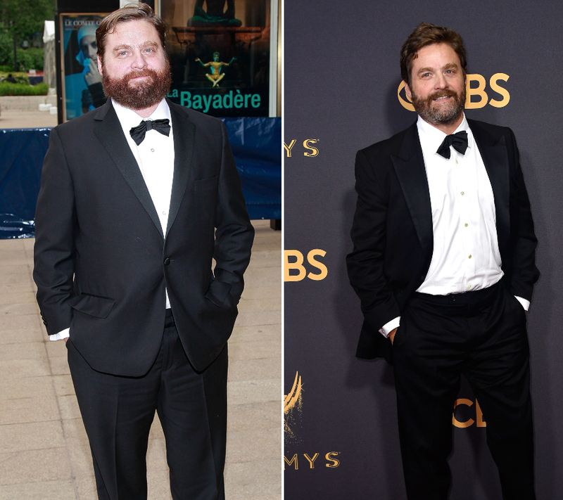 Zach Galifianakis – 22.5 kilos | Getty Images Photo by Charles Eshelman & Frazer Harrison