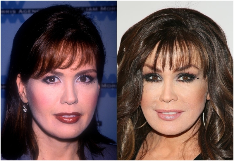 ¿Marie Osmond se sometió a una cirugía plástica? | Alamy Stock Photo by MediaPunch Inc & Getty Images Photo by Jean Baptiste Lacroix/WireImage