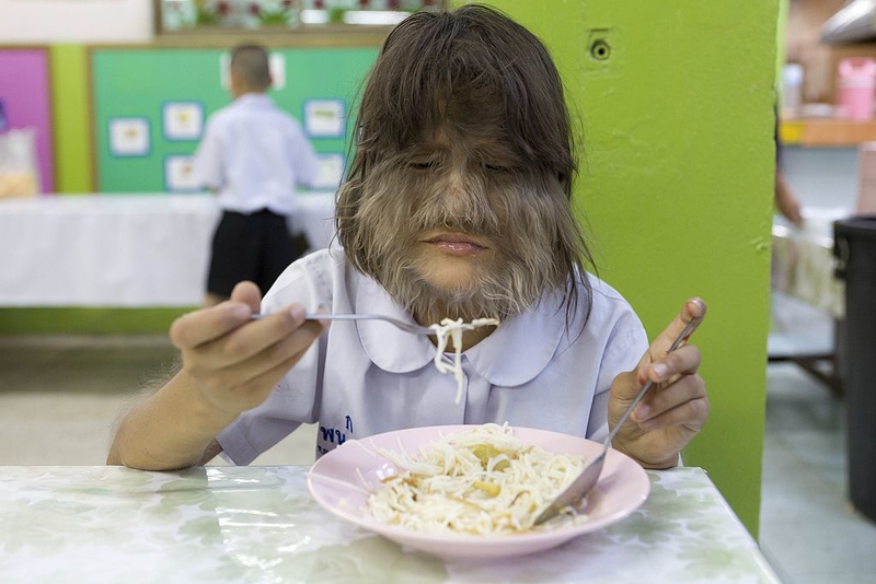 Quer Mais Cabelo? Toma! | Getty Images Photo by Bronek Kaminski/Barcroft Media