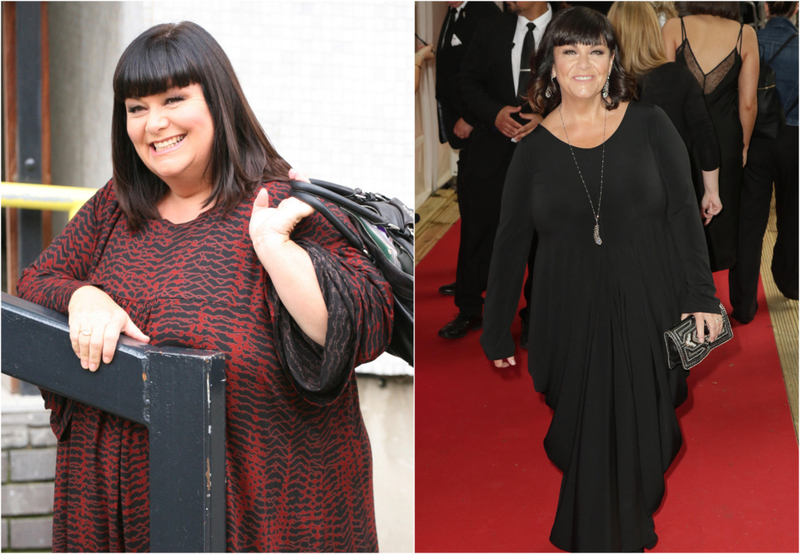 Dawn French – 44 Kg | Alamy Stock Photo