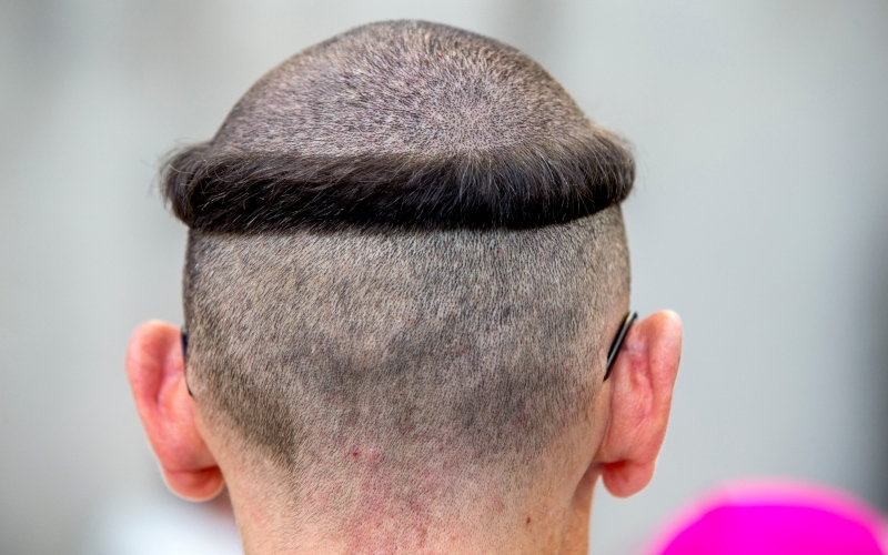 Tonsure | Adobe Stock Photo by Julian