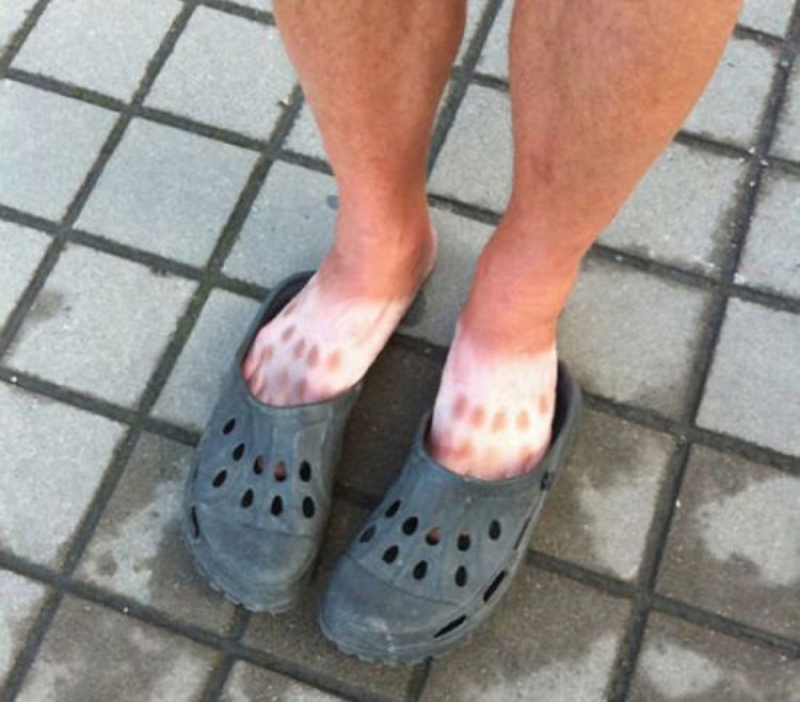 Crocs Nightmare | Imgur.com/elSuV